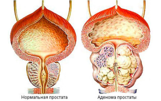 Боль в паху у мужчин справа и слева: причины и лечение