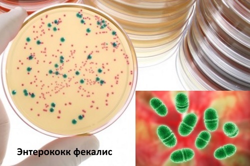 enterococcus faecalis у мужчин: норма, причины, симптомы и лечение