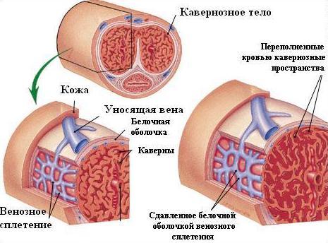 Кавернозный фиброз: симптомы (фото у мужчин), лечение