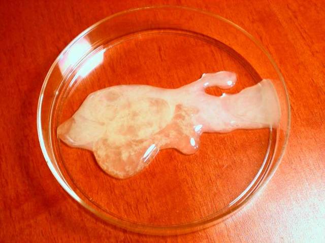 Жидкая прозрачная сперма: 12 причин, почему такой стала, что делать мужчине
