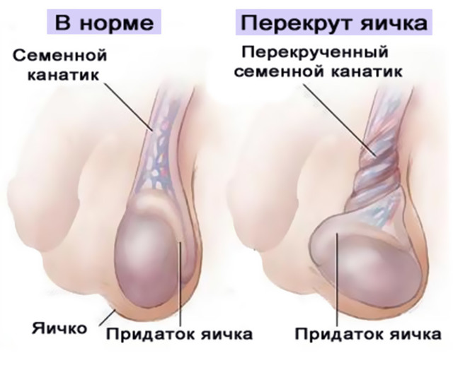 Боль в паху у мужчин справа и слева: причины и лечение