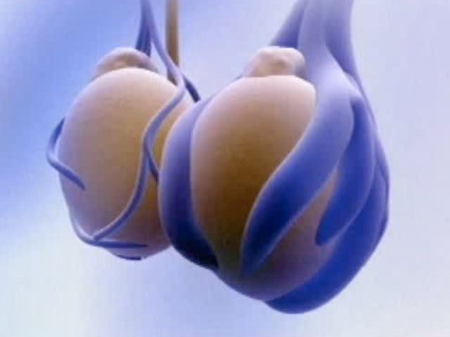 Застой спермы в яичках и простате у мужчин: симптомы, последствия, лечение