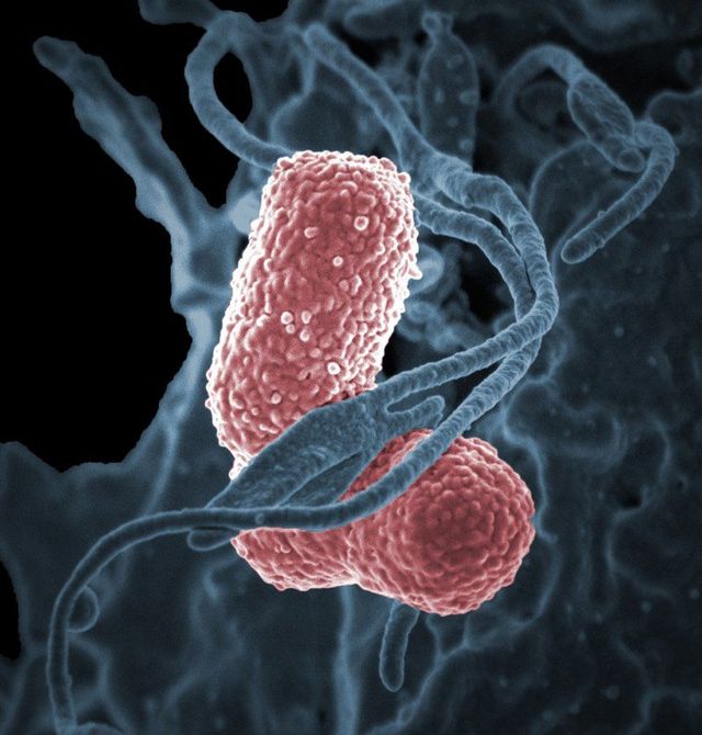 Бактериальный простатит у мужчин: причины, симптомы и лечение